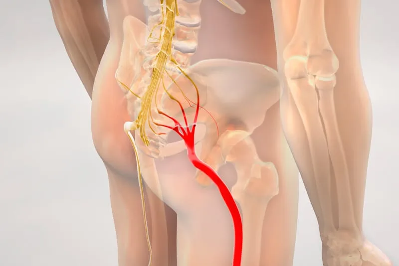 Illustration of the sciatic nerve running from the low back through the buttock and down the leg